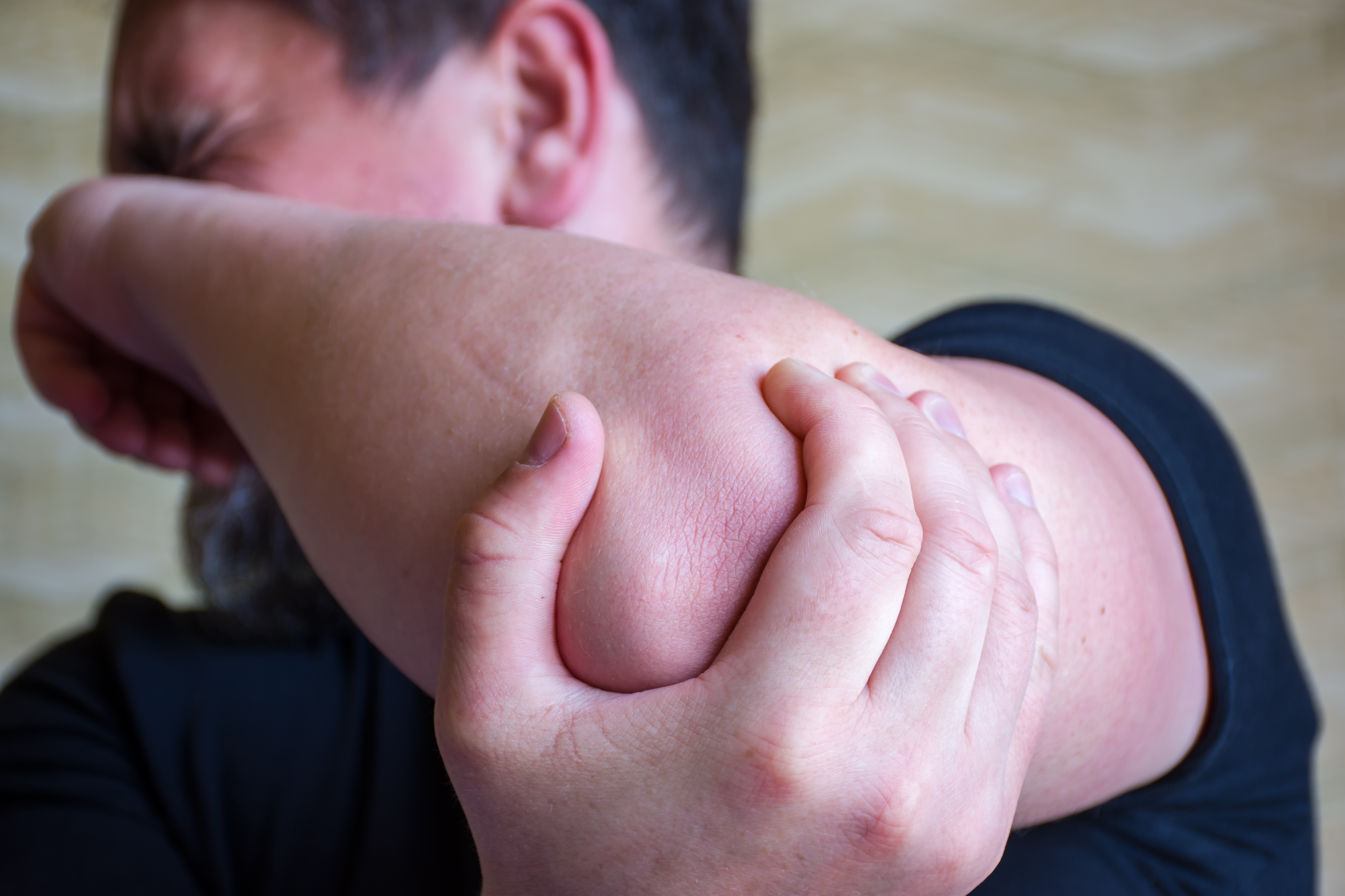 image of elbow pain on our online chiropractic CE page