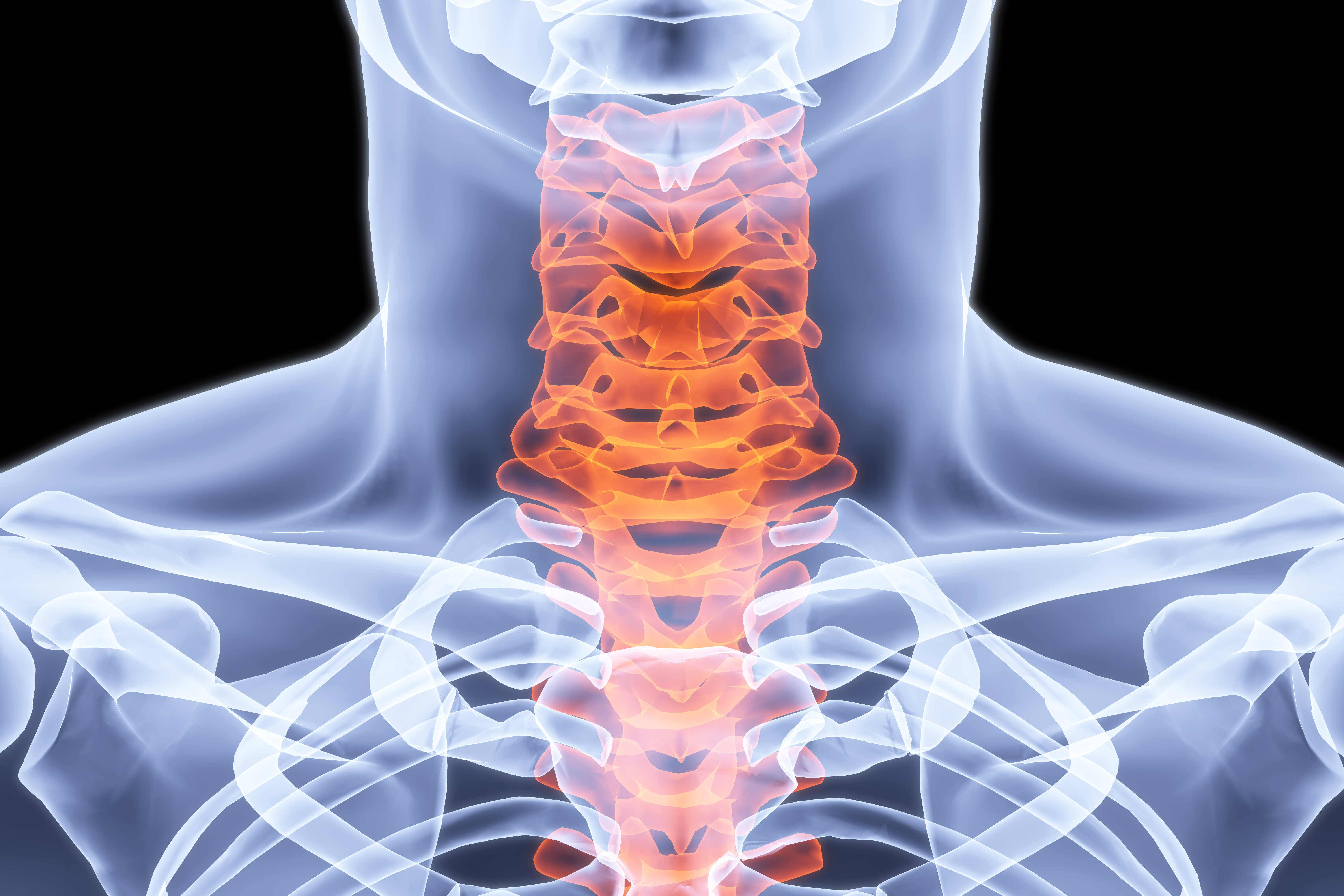 Image of cervical spine on our online chiropractic ce page