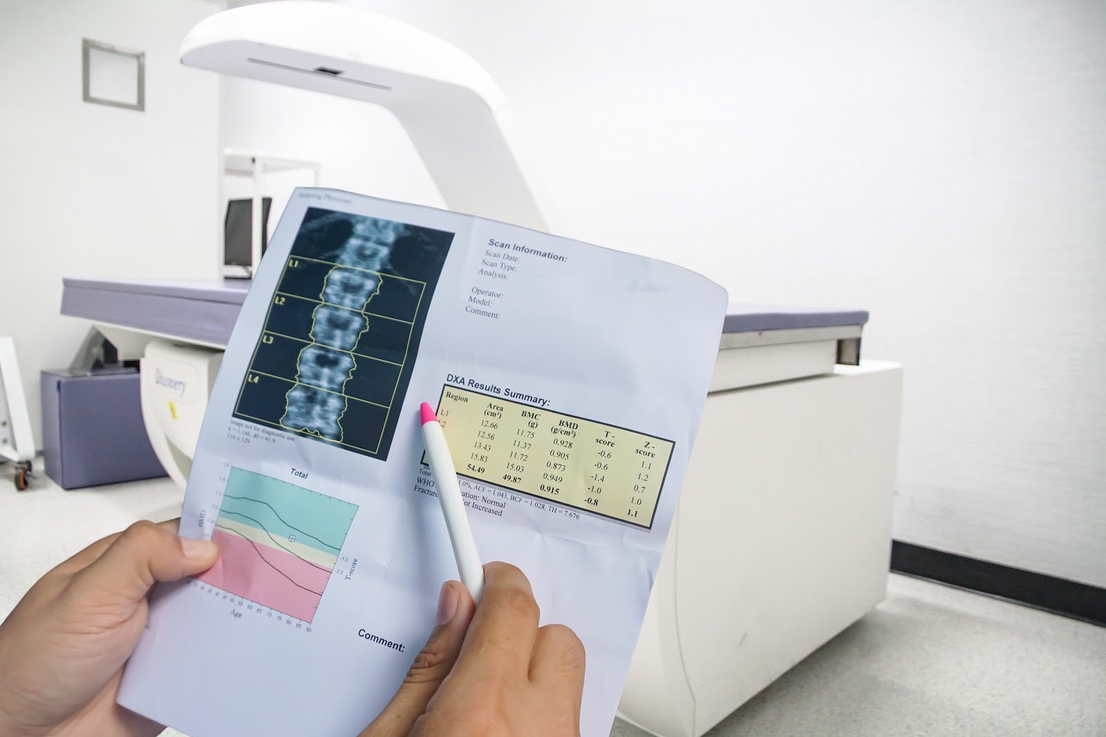 A clinician’s hands holding a printed DEXA bone-density report with spine scan images and result tables beside the densitometry scanner — the diagnostic work-up for osteoporosis that Nutrition 238 teaches chiropractors alongside nutritional management