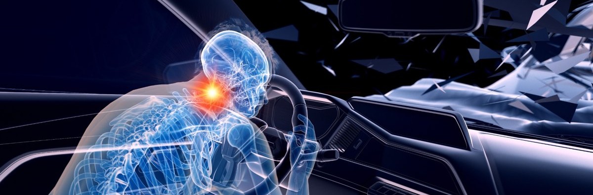 3D illustration of whiplash injury in auto accident – Chiropractic Personal Injury Certification