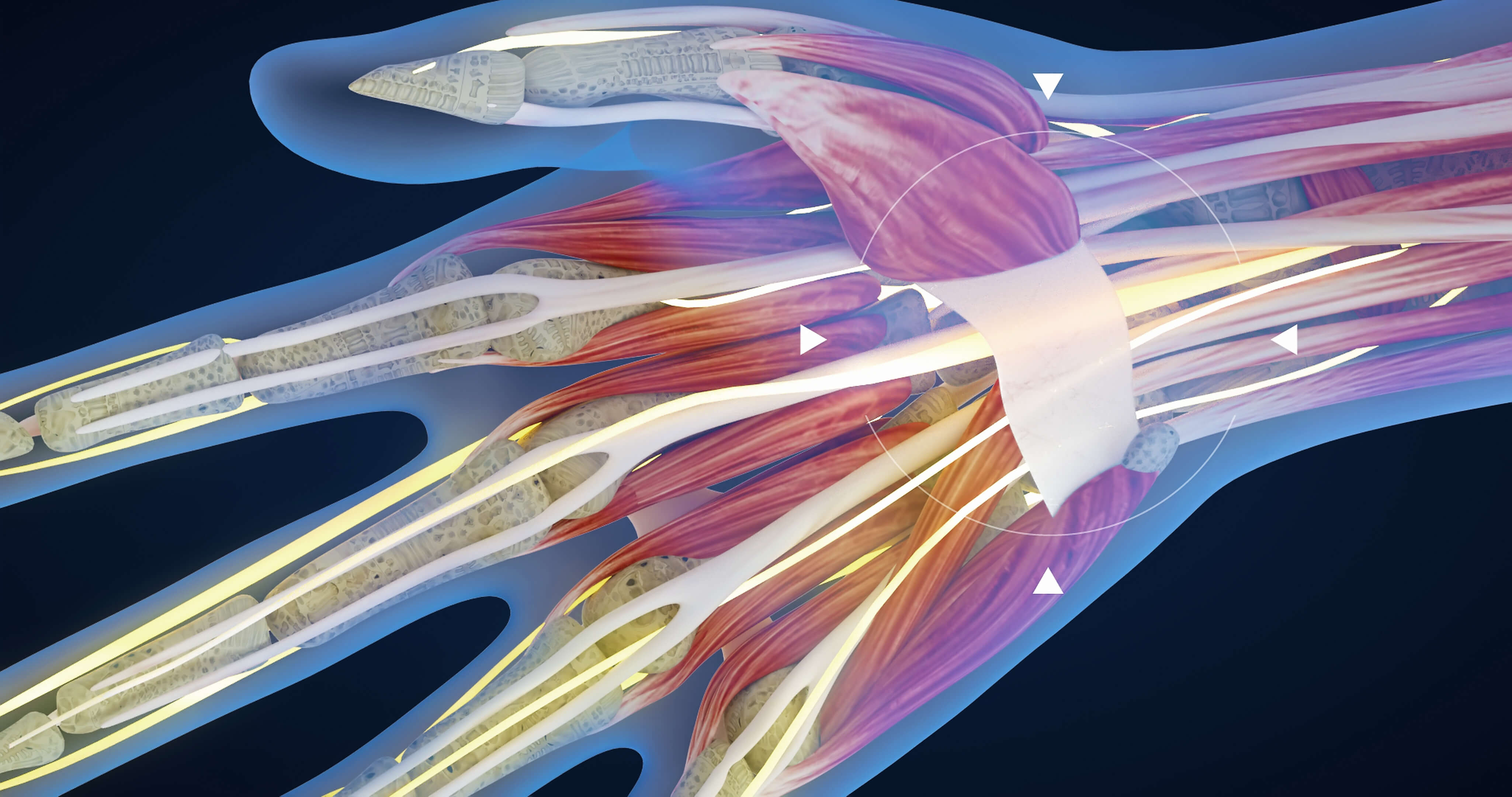 image of carpal tunnel on our chiropractic CEU page
