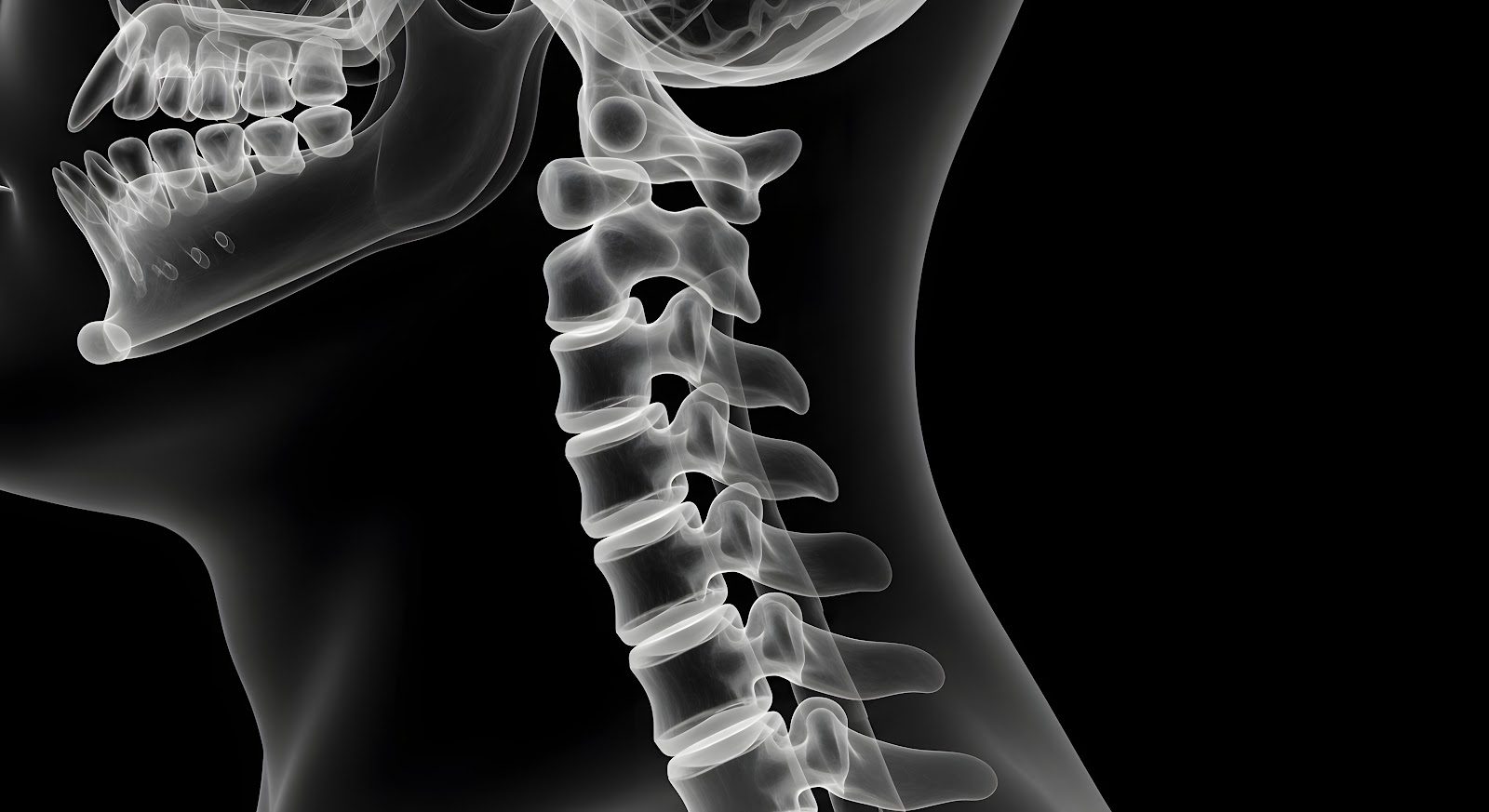 Lateral radiographic-style rendering of the cervical spine against a black background, showing the vertebral bodies and the curve of the neck