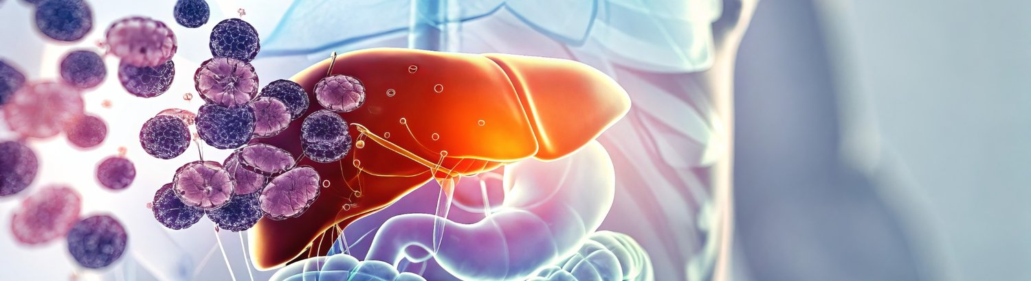 Illustration of liver detoxification process with functional medicine concept showing liver and toxins