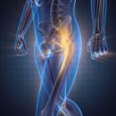 08/09/2022 7 - 9 PM CT Orthopedics 319: The Hip image