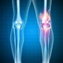 Rehabilitation 213 - The Knee: Diagnosis & Rehabilitation image