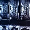 11/18/2025 7 - 9 PM CT Physical Examination 308 | The Lumbar Spine image