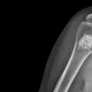 12/16/2025 7 - 9 PM CT Physical Examination of the Shoulder | Live Chiropractic Webinar image