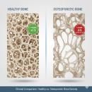 High-resolution anatomical comparison of healthy vs. osteoporotic bone microarchitecture, illustrating trabecular thinning and increased porosity for clinical chiropractic geriatric management.