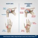 Geriatrics 204: Upper Extremity Osteoarthritis | CCEDseminars image