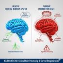 Neurology 202: Pain & the Central Nervous System | CCEDseminars image