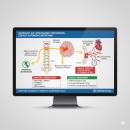 A clinical diagram illustrating the neurological connection between the upper cervical spine, the brainstem reticular formation, and the Intermediolateral (IML) cell column in blood pressure regulation, optimized for high legibility as a thumbnail.