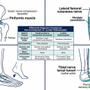 Orthopedics 203: Nerve Entrapments of the Pelvis and Lower Extremities image