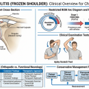 Orthopedics 206: Frozen Shoulder Evaluation | Chiropractic CE image