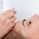 Acupuncture 210: Headache Management for Chiropractors image