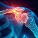 Blue translucent illustration of a shoulder with the glenohumeral joint and capsule glowing orange-red — Orthopedics 206, frozen shoulder evaluation