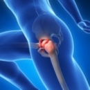 Sports Injuries 290: Hip Joint injuries image