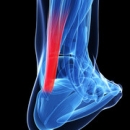 06/28/2022 7 - 9 PM CT Orthopedics 317:  Achilles Tendinitis – the Good the Bad and the Ugly  image