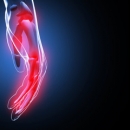 Case Studies & Clinical Pearls 218: Carpal Tunnel Syndrome (CTS) | Chiropractic CEU image