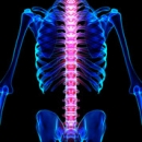 Radiology 213: Seronegative Spondyloarthropathies image