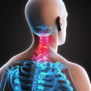 Sports Injuries 244: Cervical Spine: Disc Injuries image