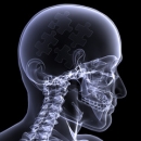 Radiology 201 Normal Variants of the Cervical Spine image
