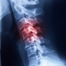 Sports Injuries 252: Cervical Spine: Joint Conditions image