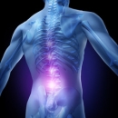 Sports Injuries 235: Lumbar Spine IIII - Joint Conditions image