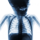 Radiology 218: Pediatric Radiology image