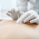 Acupuncture 207: History & Philosophy image